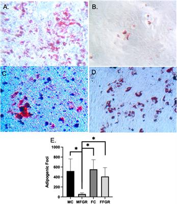 Sexual dimorphic gene expression profile of perirenal adipose tissue in ovine fetuses with growth restriction